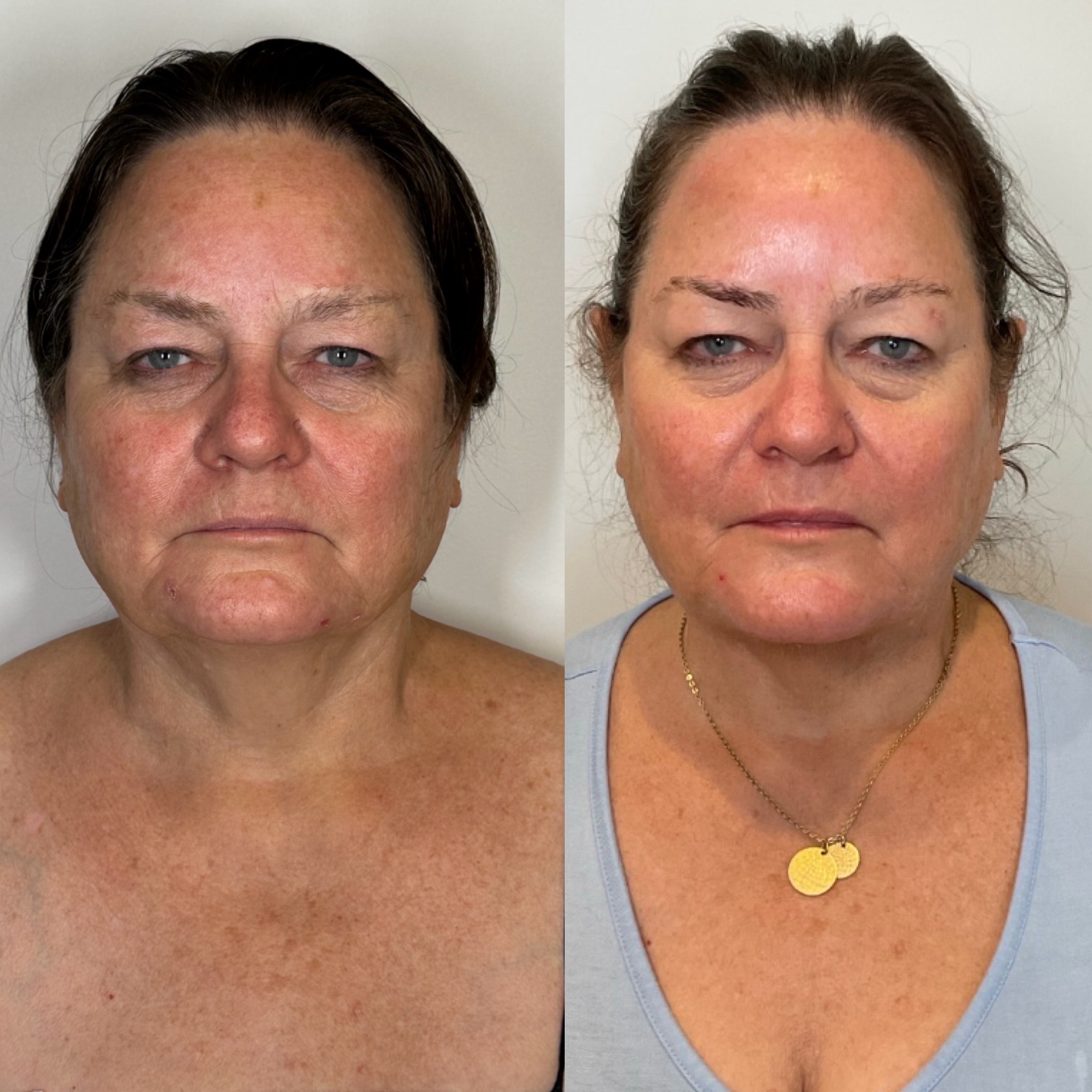 https://www.theperfectdose.com/wp-content/uploads/2024/10/facetite.jpg