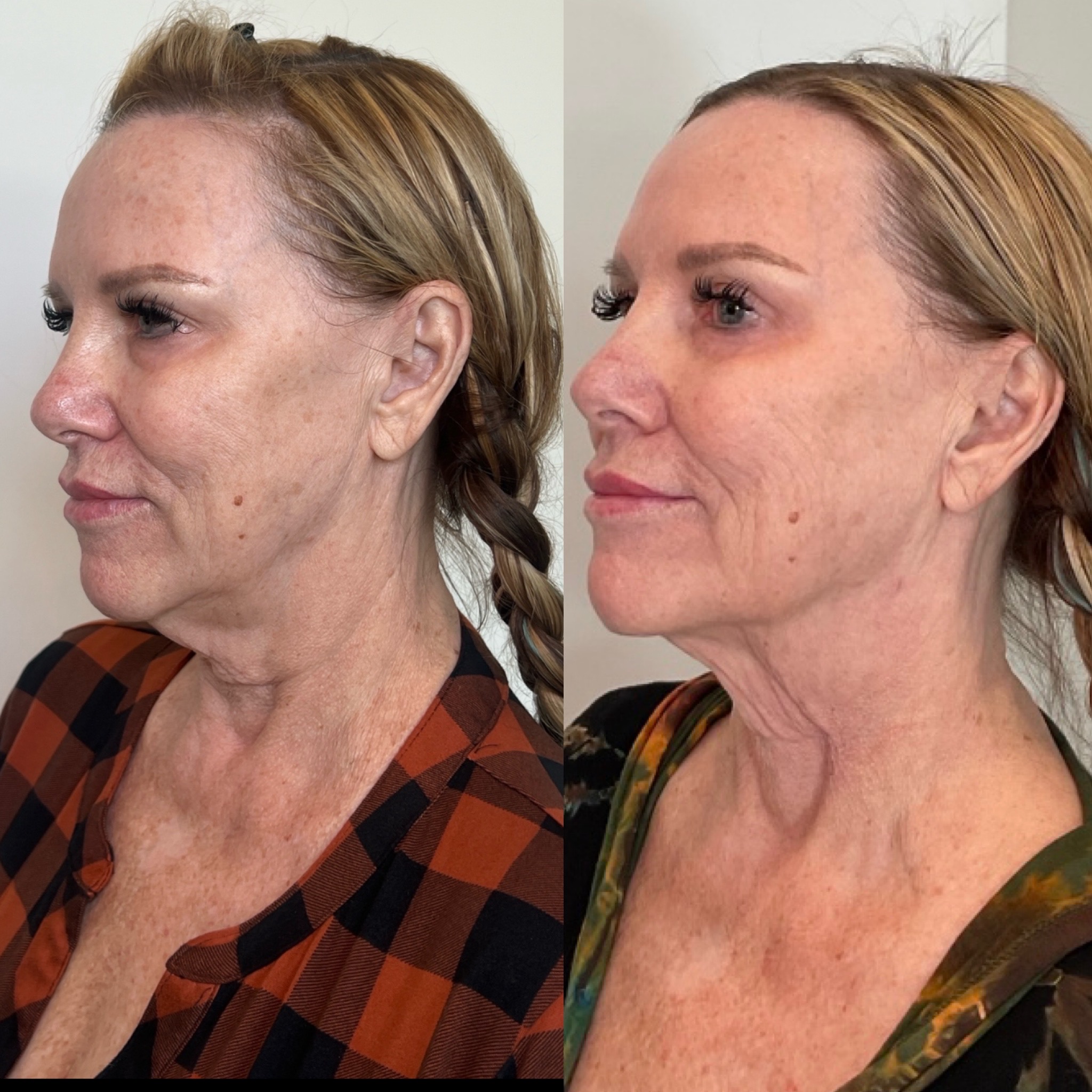 https://www.theperfectdose.com/wp-content/uploads/2025/02/facetite.jpg