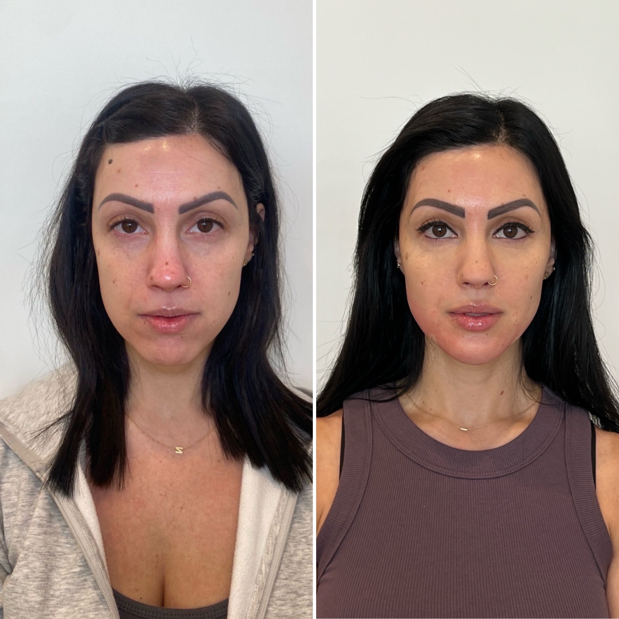 https://www.theperfectdose.com/wp-content/uploads/2025/06/Full-facial-balancing-02.12.2025.jpeg