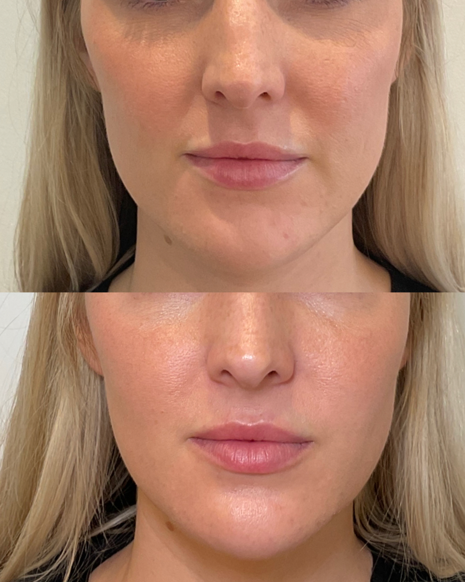 https://www.theperfectdose.com/wp-content/uploads/2025/07/skinvive-2.jpg