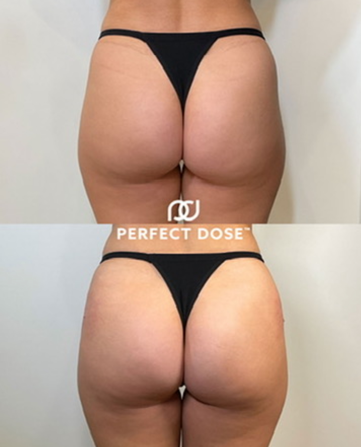 https://www.theperfectdose.com/wp-content/uploads/2025/09/IMG_9971.jpeg